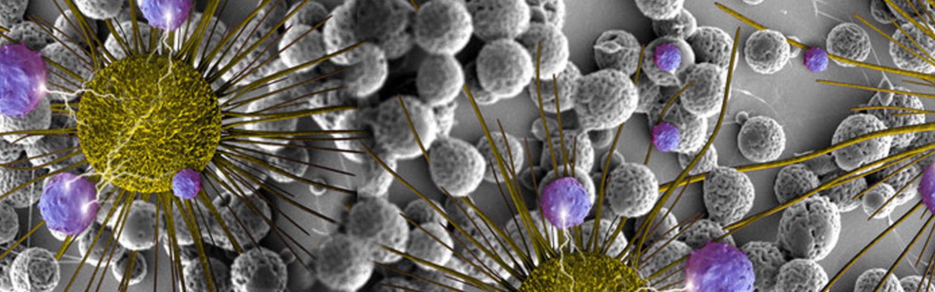 Scanning electron micrograph of BCNU-loaded microspheres (black and white background) with 3d rendered images of brain cancers c